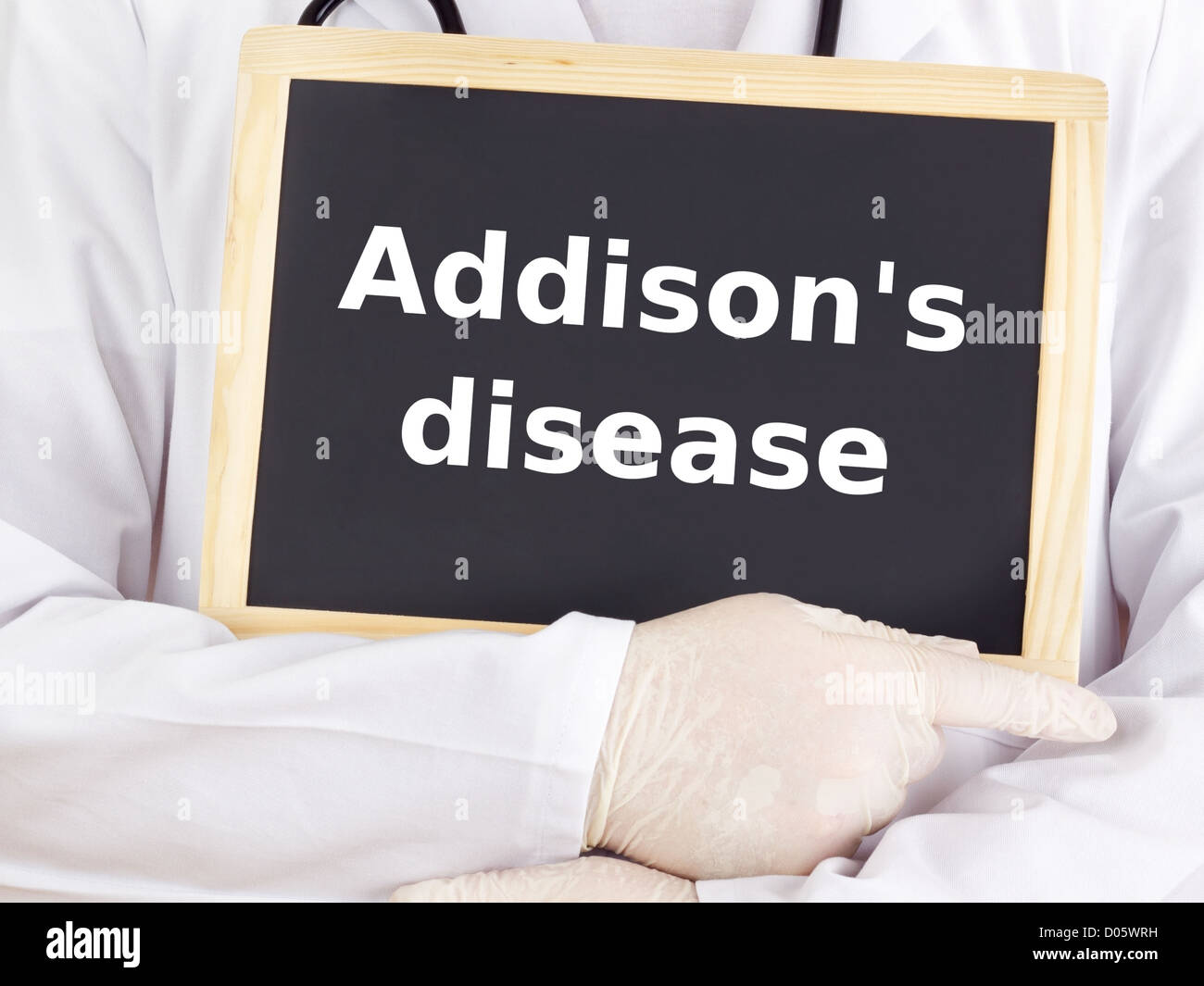 Doctor shows information on blackboard addison`s disease Stock Photo